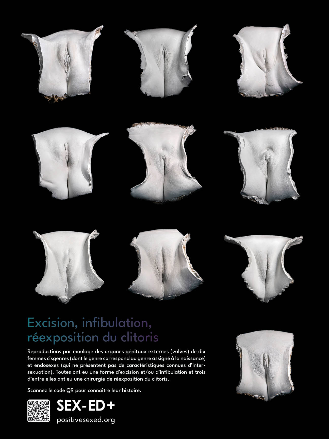 Poster - Excision, Infibulation and clitoral re-exposition - SEX-ED +