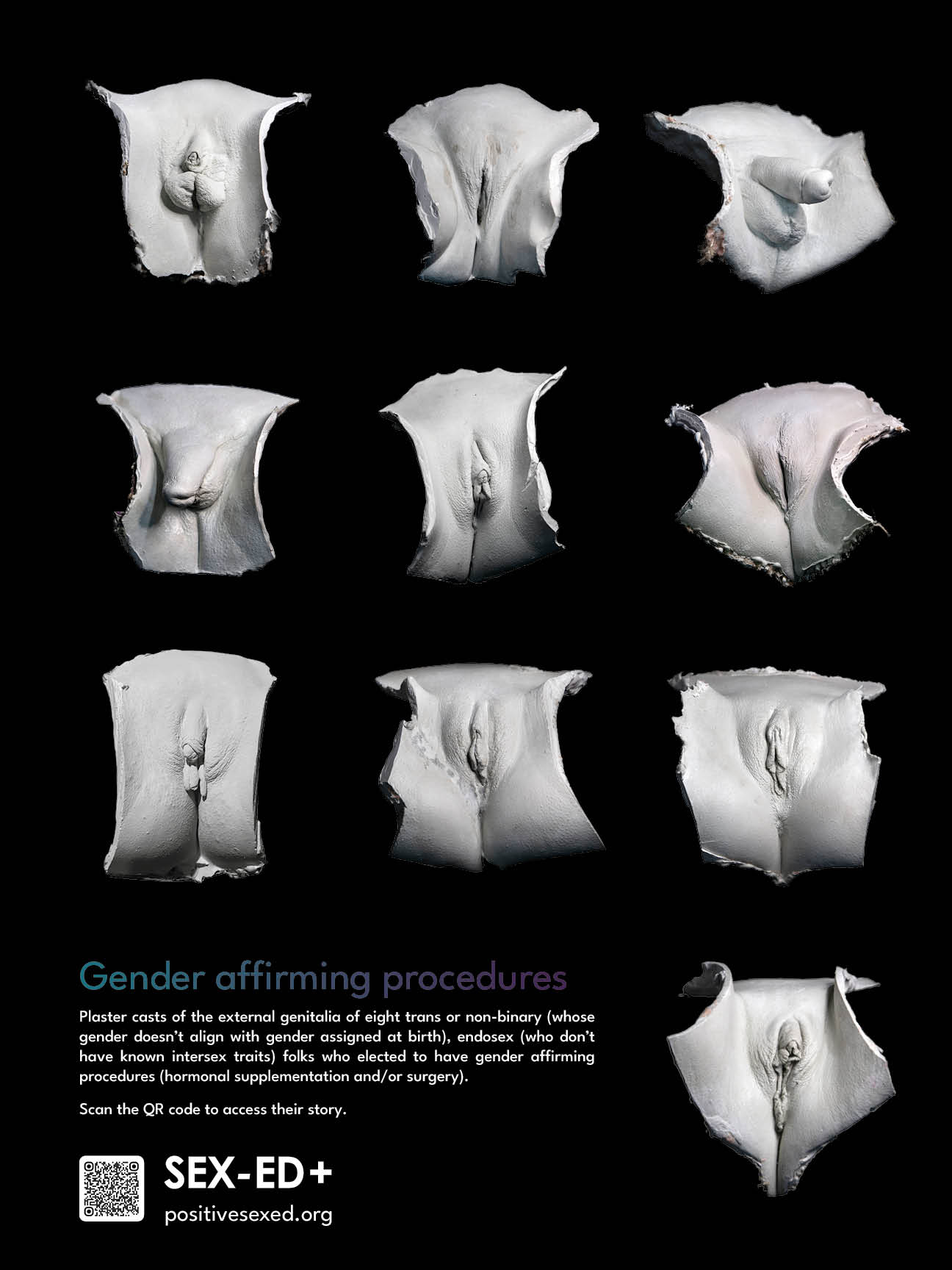 Poster gender affirming procedures. 8 models (24/18 inches - 61/46cm)