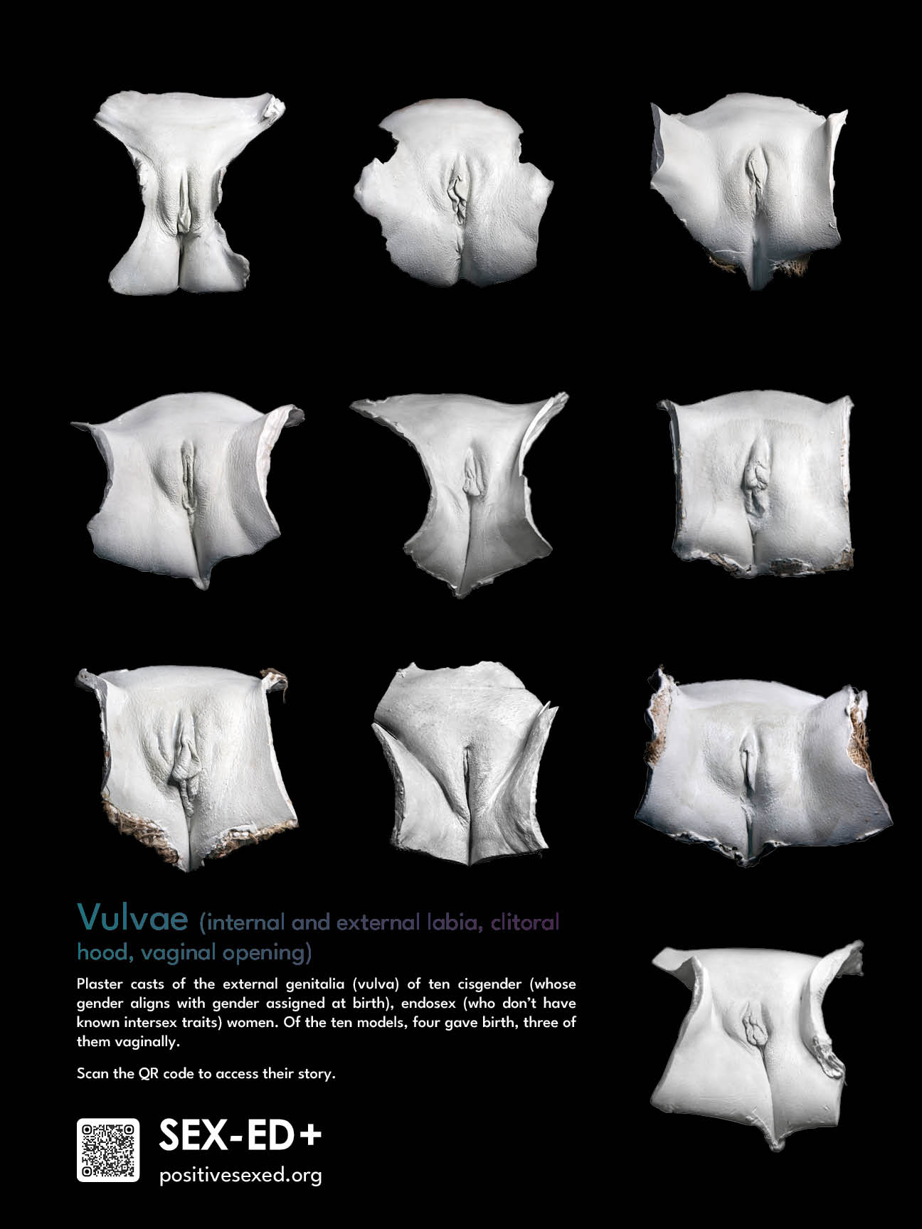 Poster vulvae. 10 models (24/18 inches - 61/46cm)