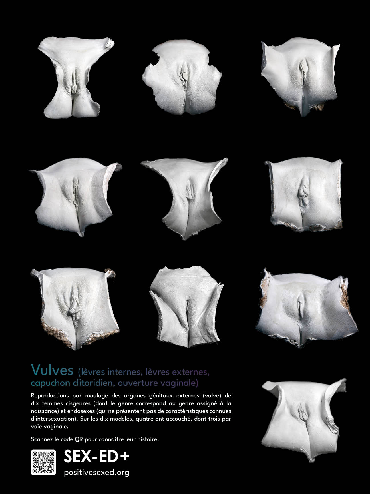 Poster vulves (lèvres internes, lèvres externes, capuchon clitoridien, ouverture vaginale). 10 Modèles (61/45cm - 24/18 pouces)